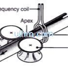 high frequency induction welding (HFIW) continuous butt welding of tubes